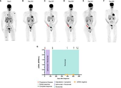 Case report: Real-world experience using a personalized cancer-specific circulating tumor DNA assay in different metastatic melanoma scenarios